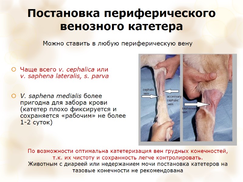 Постановка периферического венозного катетера Чаще всего v. cephalica или v. saphena lateralis, s. parva